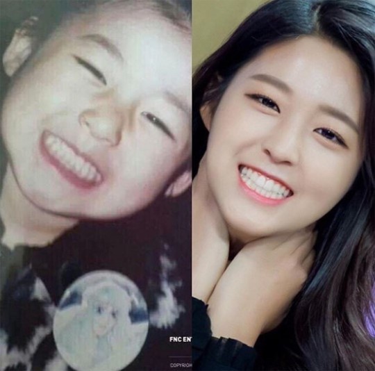 雪炫31日在INS上传了一张小时候和现在模样照