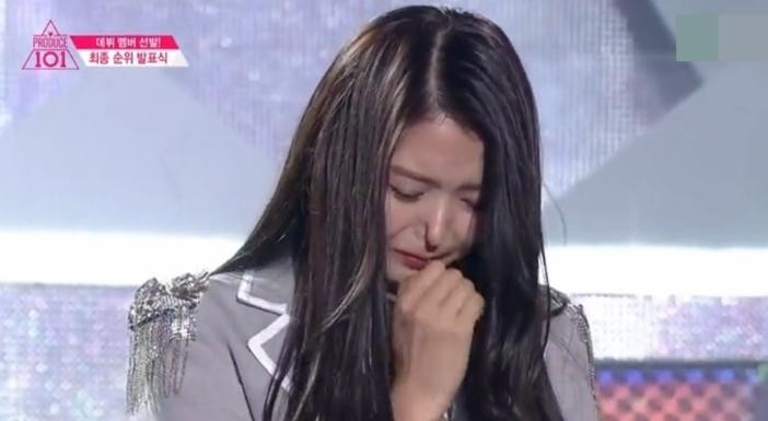 韩女星任娜英整容后遗症