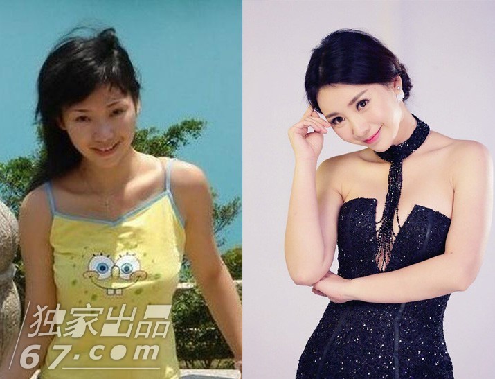 宅男女神柳岩出道前的照片曝光后曾引发整容争议