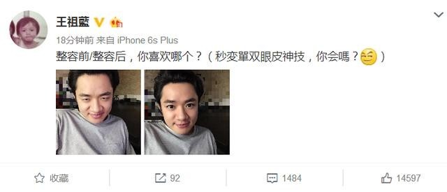 王祖蓝亲口承认已经整容了，真的吗？