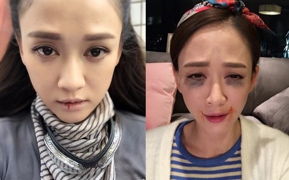 为什么陈乔恩一天要吃75颗药？