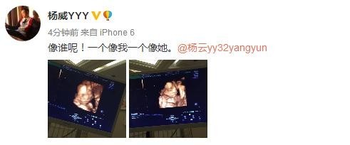杨威晒杨云腹中胎儿B超照，而且还是龙凤胎？