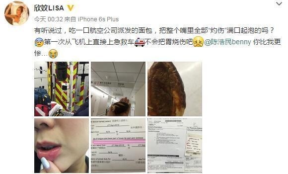 陈浩民妻子蒋丽莎在飞机上吃面包而被烫伤了?