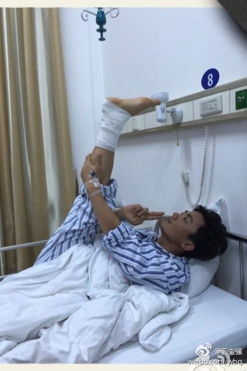 王宝强微博晒出一组照片，他透露脚打钢板拍了两年电影