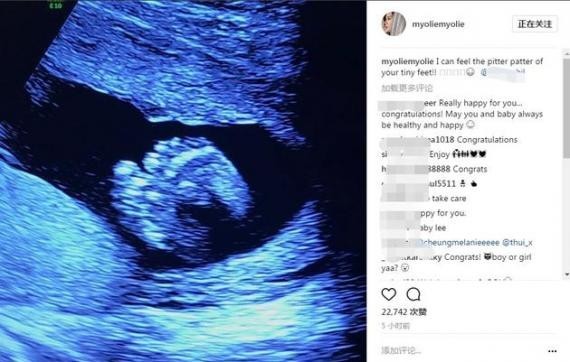 胡杏儿在社交网晒出一张孕肚超声波照片
