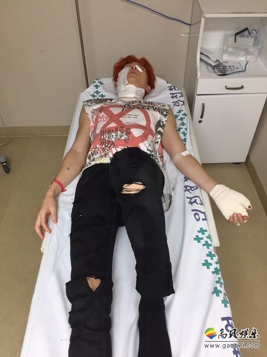 U-Kiss拍摄MV传出意外事故  基燮在拍摄中爆炸意外身体二度灼伤