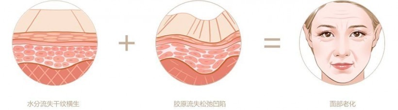 科学家对早衰症儿童细胞进行研究，目的是更深入了解衰老过程