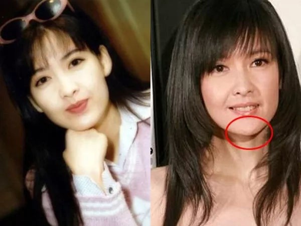 八九十年代香港女明星整容也不少各有风情