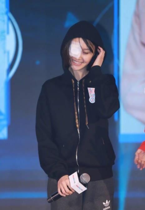 郑爽参加某档综艺发布会：黑色卫衣素颜现身！被发现右眼蒙着纱布