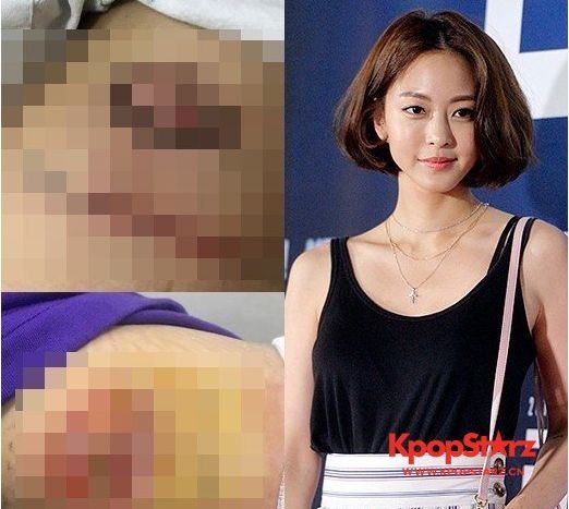 韩艺瑟被爆索要巨额补偿   超过原来两倍的巨额补偿金