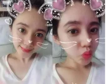 孕妈秋瓷炫晒出三连拍：配合贴纸做出卖萌的表情，十分可爱，皮肤紧致