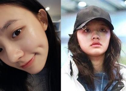刚刚宣布自己瘦了14斤的林允:关掉美颜纯素颜亮相,引来大批网友围观 刚刚宣布自己瘦了14斤的林允:关掉美颜纯素颜亮相,引来大批网友围观