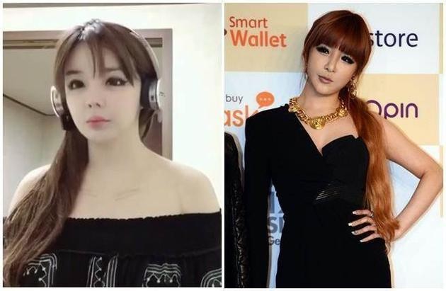 朴春重返演艺圈   僵硬不自然的脸蛋与昔日差很大