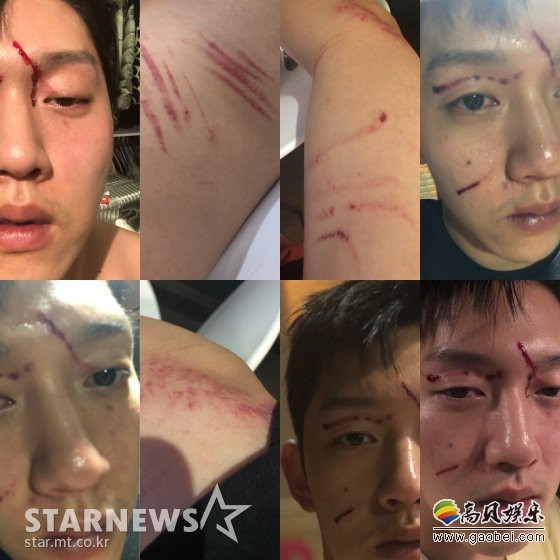 崔某通过媒体主张遭受具荷拉暴行的一方  公开了相关照片