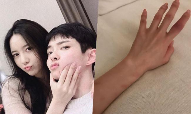 韩瑞希晒出布满淤青和红肿手臂照片，向友人求助对话截图，究竟发生什么