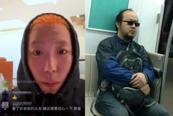 窦靖童直播中她秀出自己橙色板寸头，她坦言害怕遗传爸爸窦唯脱发成秃头