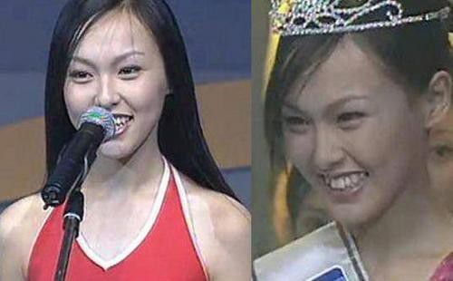 网友挖出唐嫣18岁参加选美青涩照片，身穿性感泳装，一双大长腿十分吸睛